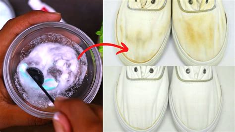 Magic shoe stain remover: the ultimate tool for shoe maintenance